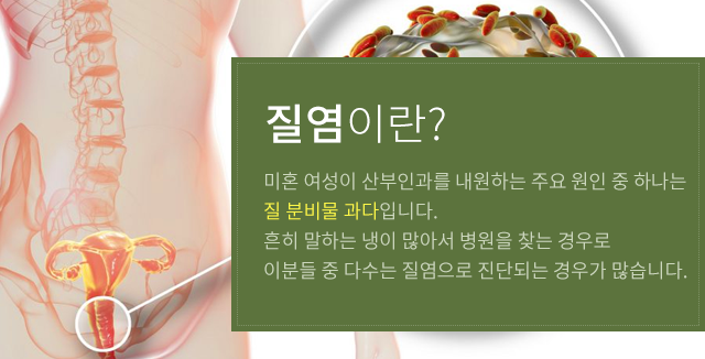 질염이란?