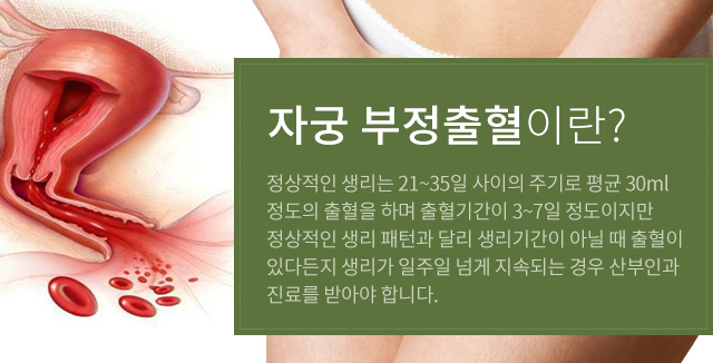 부정출혈이란?