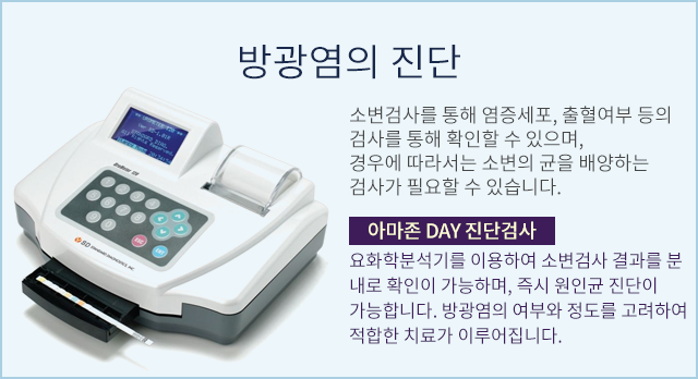 아마존 DAY 진단검사