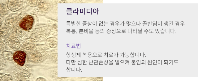 클라미디아