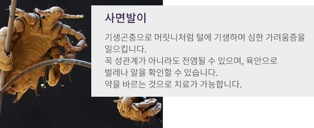 사면발이