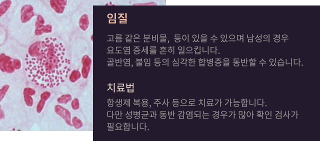 임질